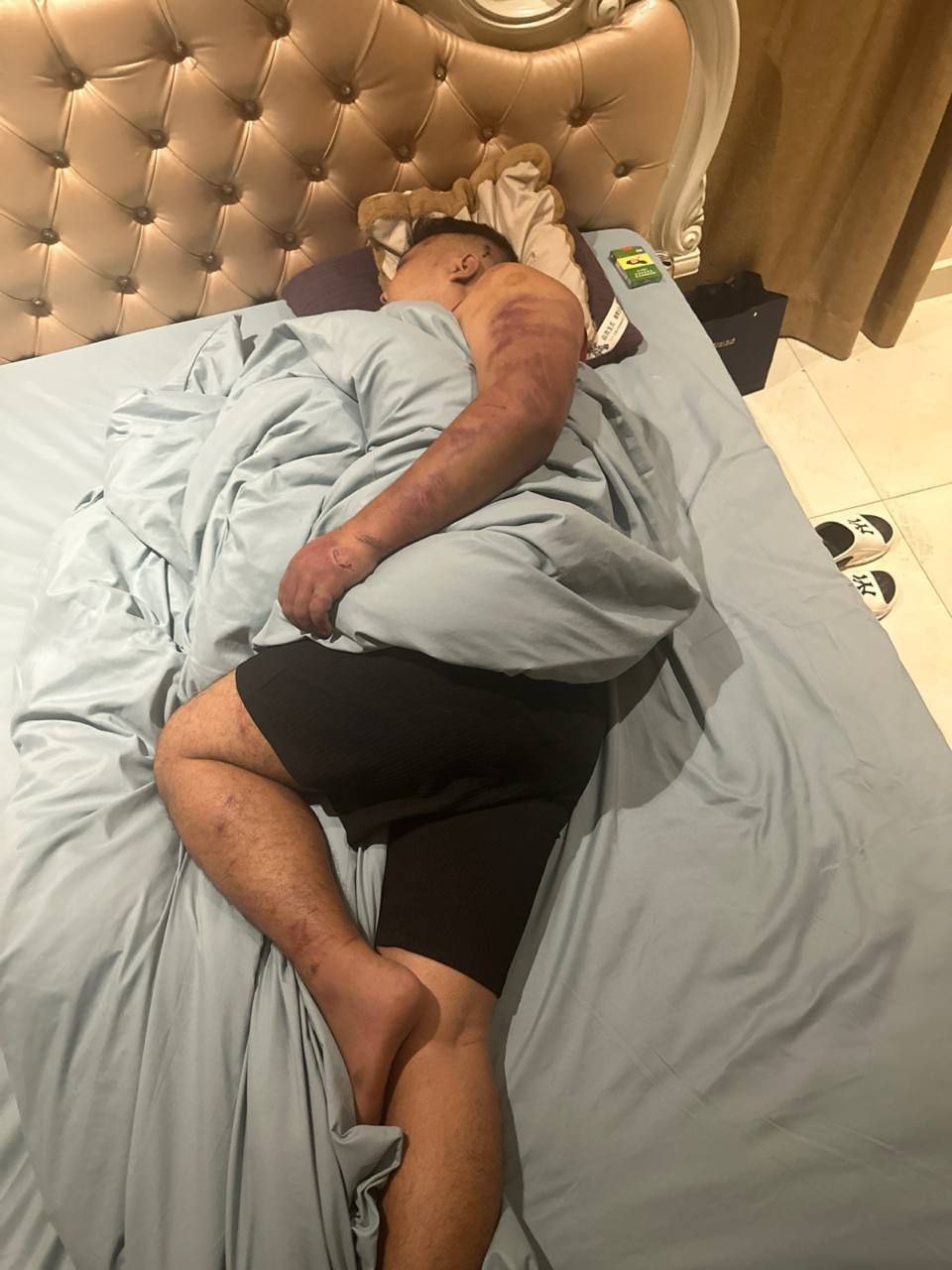 化名小马!周润发!盘口总监!因为公司欠他20多万U让我帮自导自演绑架!管公司要钱!期间只要公司的钱!跟我也协商好钱要回来会给我一部分!看公司不拿钱赎他!告诉我自己需要跑回去!这几天照片还有文字!真绑架他会这样吗!就是这样的状态吗